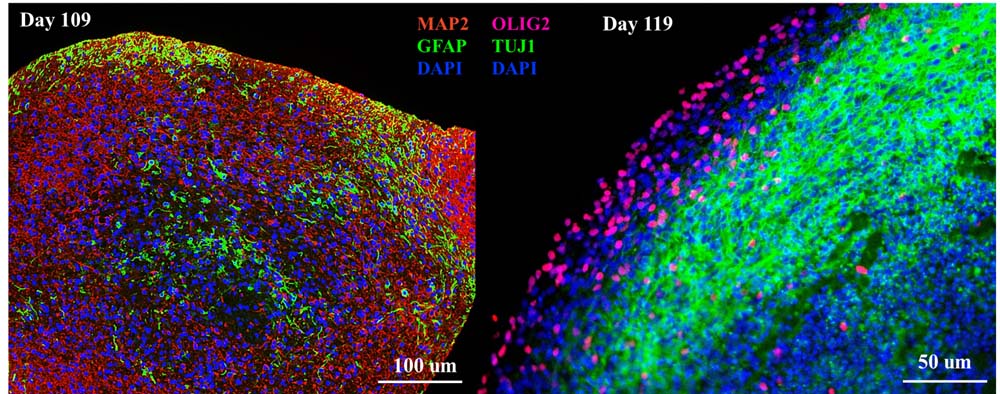  Organoids MARKER EXPRESSION