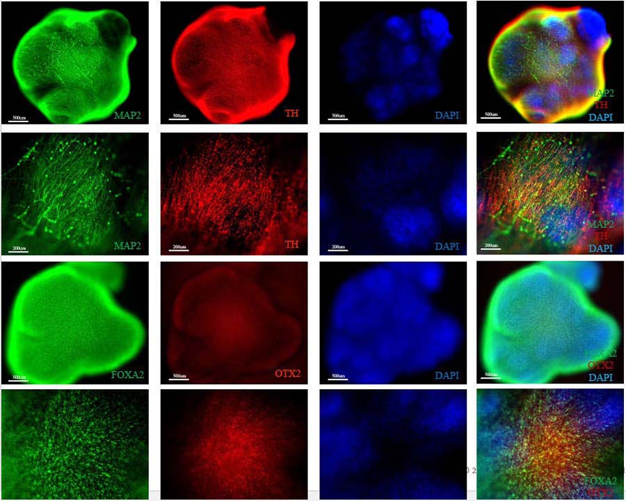  Organoids MARKER EXPRESSION